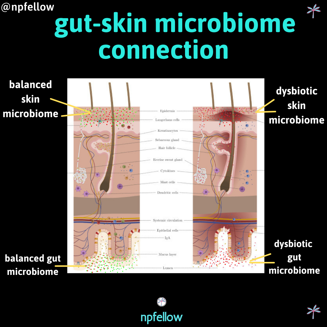 The Gut-Skin Axis