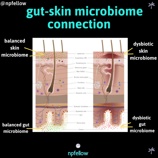 The Gut-Skin Axis